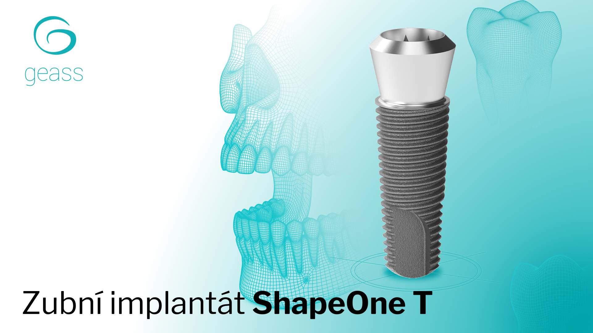 Zubní implantát ShapeOne T
