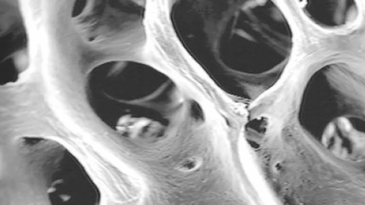 Pokročilé postupy v řízené kostní regeneraci a augmentaci