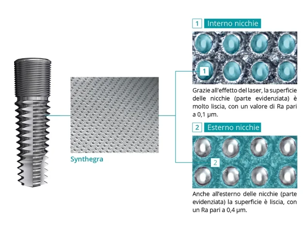 Synthegra: Evoluce v úpravě povrchu zubních implantátů